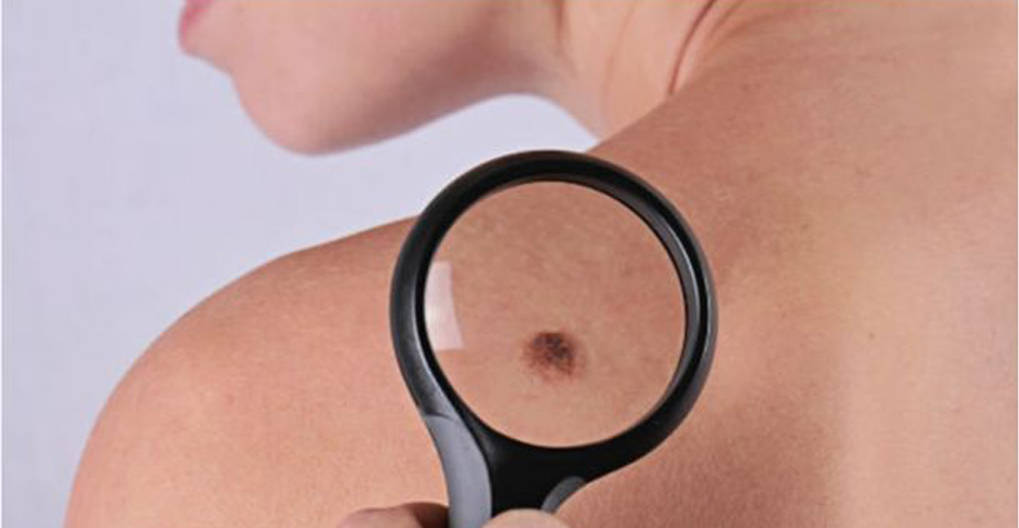Skin-Biopsy